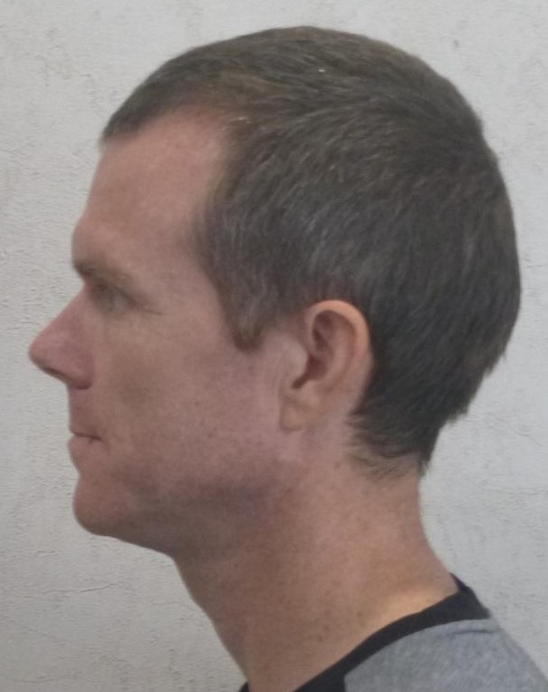 Mugshot Side